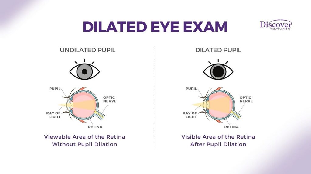 Vision Center South